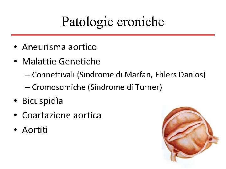 Patologie croniche • Aneurisma aortico • Malattie Genetiche – Connettivali (Sindrome di Marfan, Ehlers