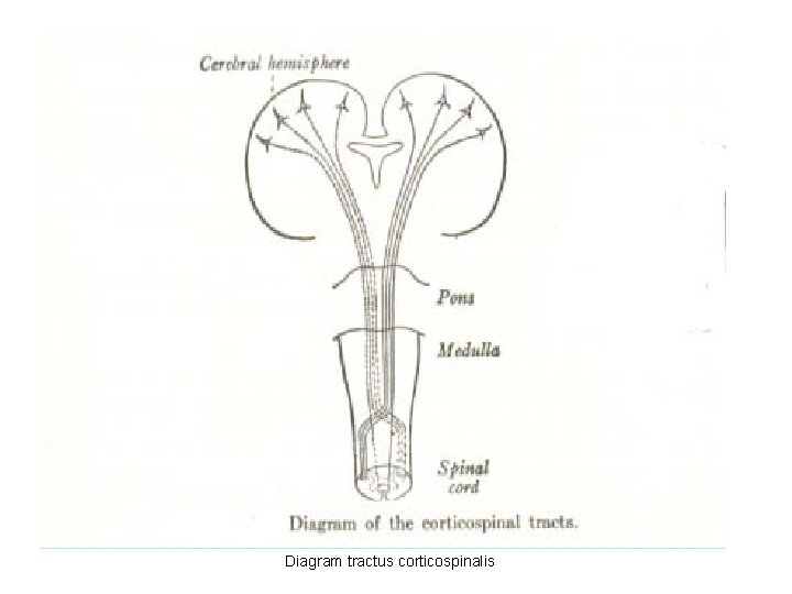 Diagram tractus corticospinalis 
