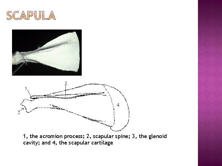 1, the acromion process; 2, scapular spine; 3, the glenoid cavity; and 4, the 1, the acromion process; 2, scapular spine; 3, the glenoid cavity; and 4, the