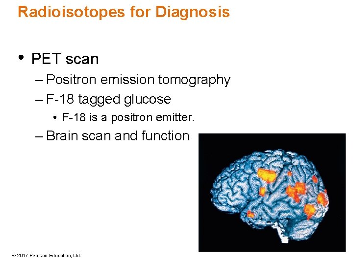 Radioisotopes for Diagnosis • PET scan – Positron emission tomography – F-18 tagged glucose Radioisotopes for Diagnosis • PET scan – Positron emission tomography – F-18 tagged glucose