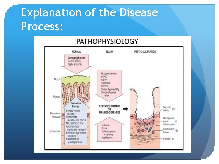 Explanation of the Disease Process: 