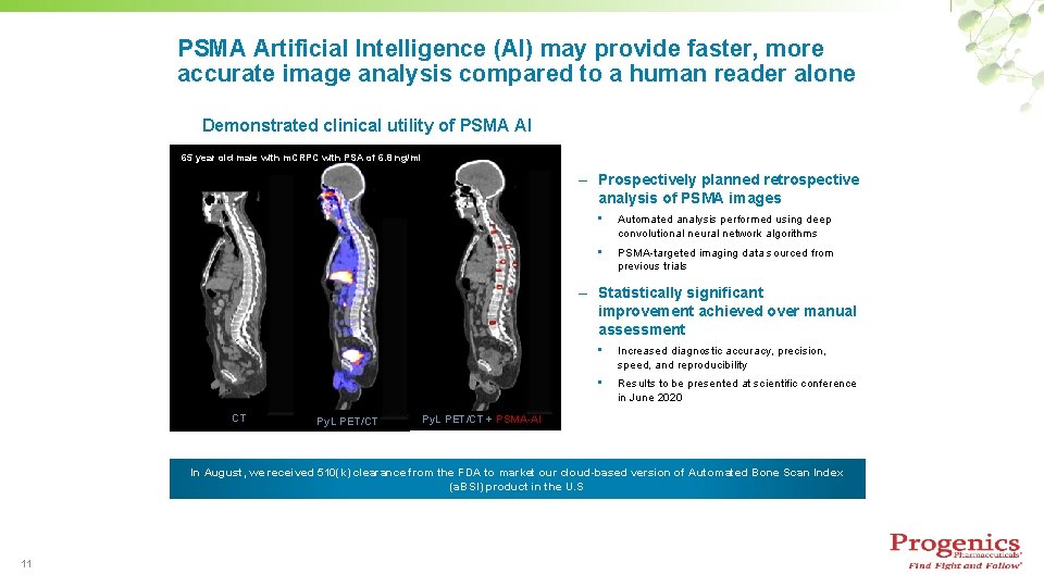 PSMA Artificial Intelligence (AI) may provide faster, more accurate image analysis compared to a