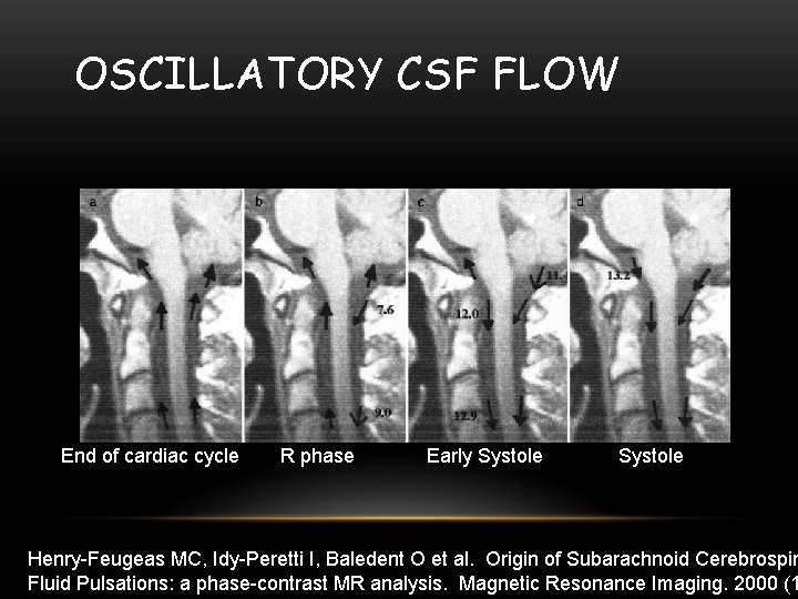 OSCILLATORY CSF FLOW End of cardiac cycle R phase Early Systole Henry-Feugeas MC, Idy-Peretti