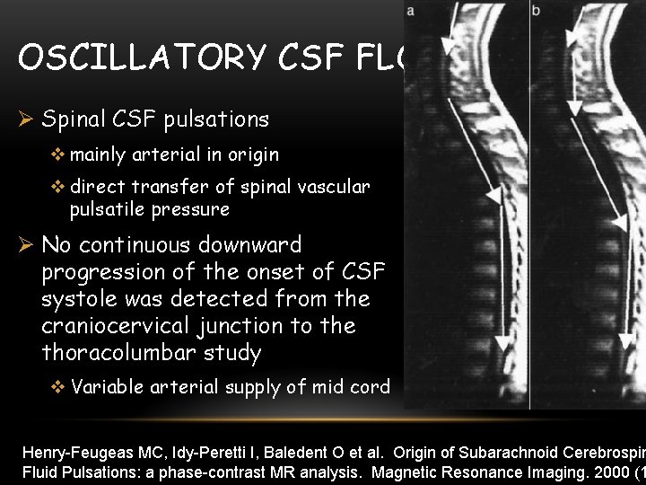 OSCILLATORY CSF FLOW Ø Spinal CSF pulsations v mainly arterial in origin v direct
