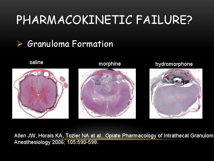 PHARMACOKINETIC FAILURE? Ø Granuloma Formation saline morphine hydromorphone Allen JW, Horais KA, Tozier NA