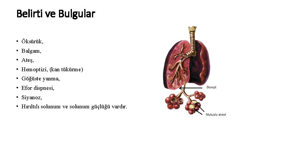 Belirti ve Bulgular • Öksürük, • Balgam, • Ateş, • Hemoptizi, (kan tükürme) •