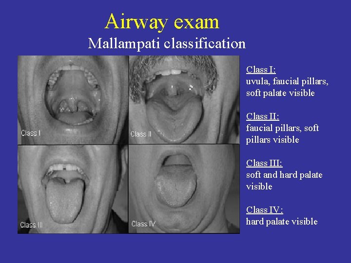 Airway exam Mallampati classification Class I: uvula, faucial pillars, soft palate visible Class II:
