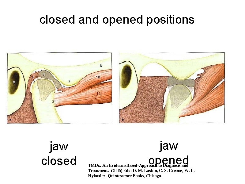 closed and opened positions jaw closed jaw opened TMDs: An Evidence Based-Approach to Diagnosis