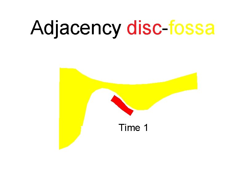 Adjacency disc-fossa Time 1 