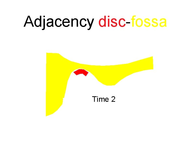 Adjacency disc-fossa Time 2 