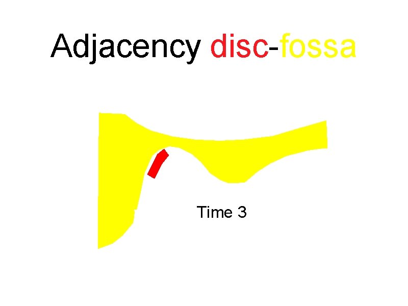 Adjacency disc-fossa Time 3 