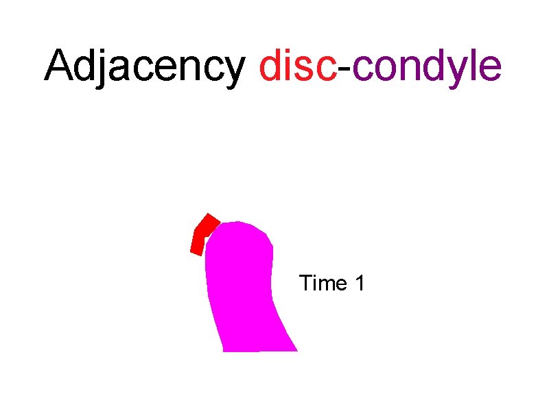 Adjacency disc-condyle Time 1 