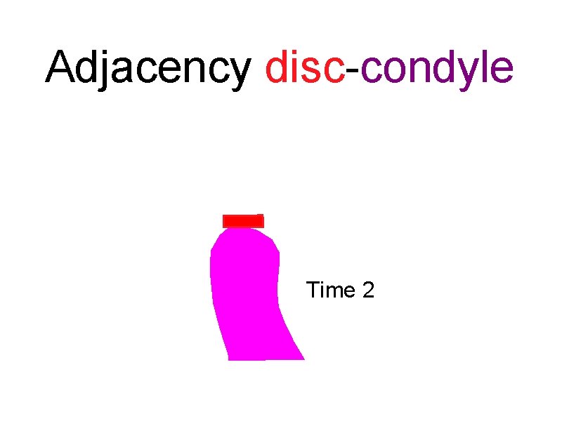 Adjacency disc-condyle Time 2 