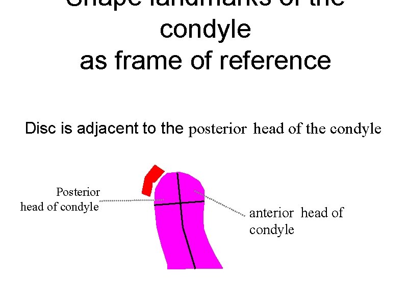 Shape landmarks of the condyle as frame of reference Disc is adjacent to the