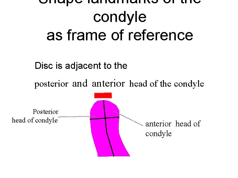 Shape landmarks of the condyle as frame of reference Disc is adjacent to the