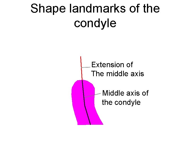 Shape landmarks of the condyle Extension of The middle axis Middle axis of the