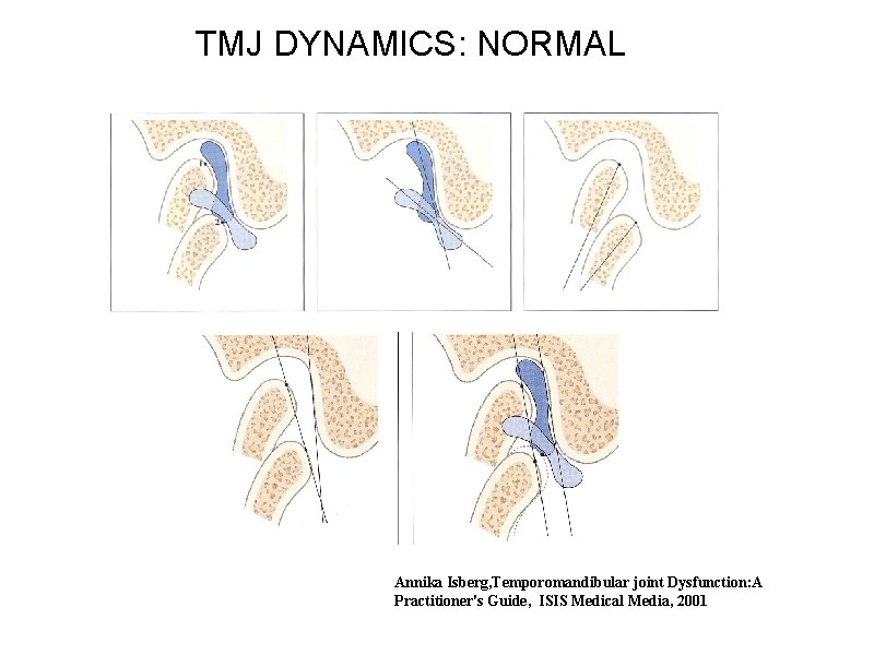 TMJ DYNAMICS: NORMAL Annika Isberg, Temporomandibular joint Dysfunction: A Practitioner's Guide, ISIS Medical Media,