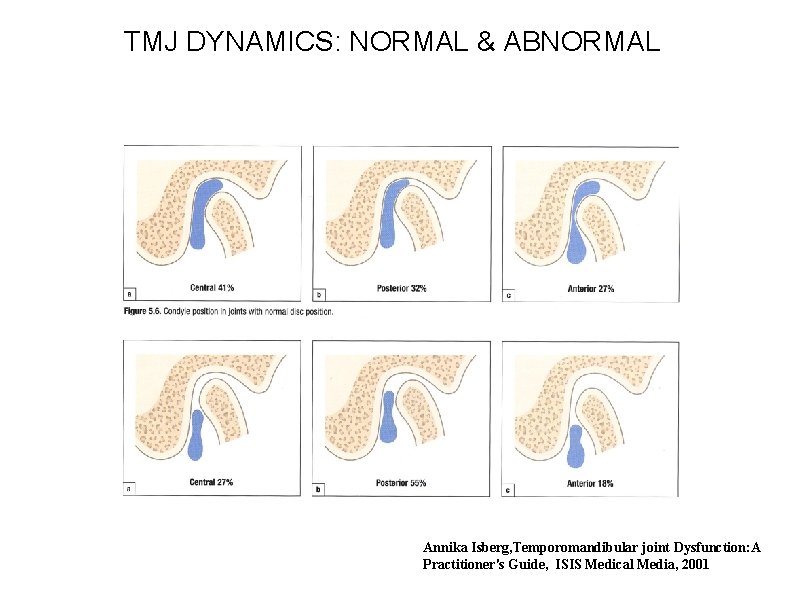 TMJ DYNAMICS: NORMAL & ABNORMAL Annika Isberg, Temporomandibular joint Dysfunction: A Practitioner's Guide, ISIS