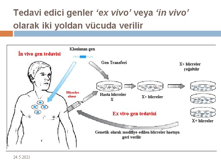 Tedavi edici genler ‘ex vivo’ veya ‘in vivo’ olarak iki yoldan vücuda verilir 24.