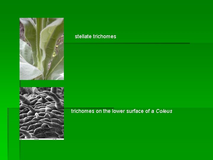 stellate trichomes on the lower surface of a Coleus 