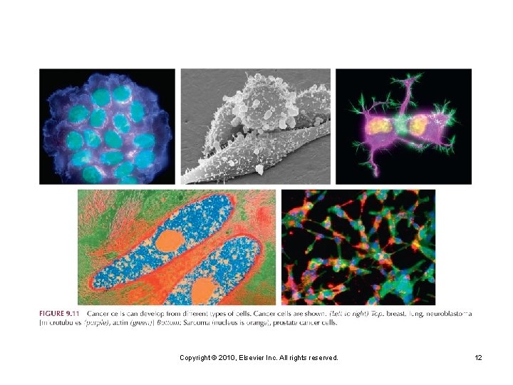Copyright © 2010, Elsevier Inc. All rights reserved. 12 