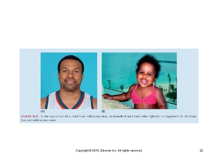 Copyright © 2010, Elsevier Inc. All rights reserved. 22 