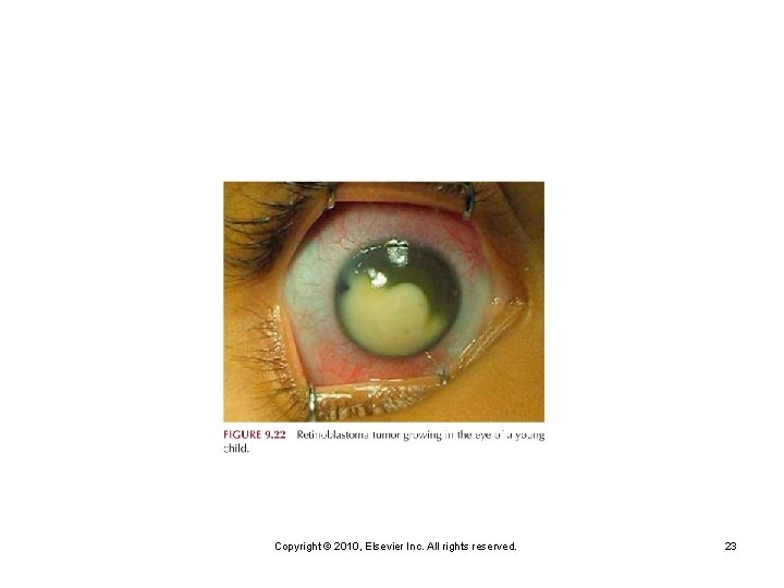 Copyright © 2010, Elsevier Inc. All rights reserved. 23 