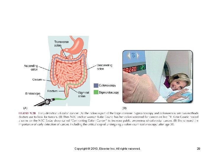 Copyright © 2010, Elsevier Inc. All rights reserved. 29 