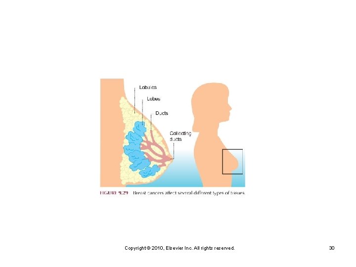 Copyright © 2010, Elsevier Inc. All rights reserved. 30 