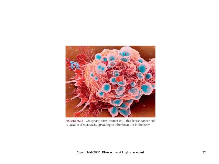 Copyright © 2010, Elsevier Inc. All rights reserved. 32 