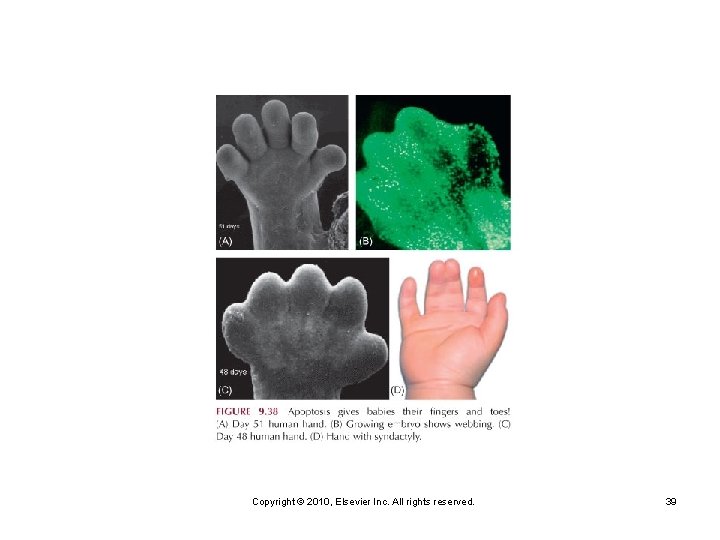 Copyright © 2010, Elsevier Inc. All rights reserved. 39 