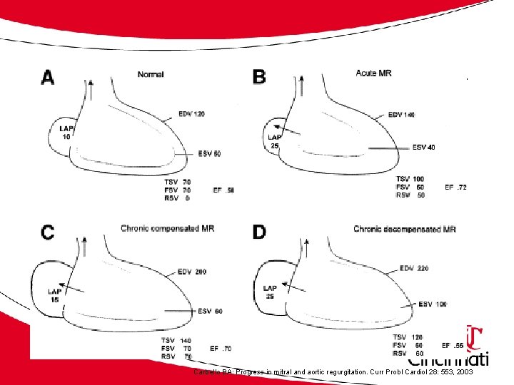 Acute and Chronic Physiology Carbello BA: Progress in mitral and aortic regurgitation. Curr Probl