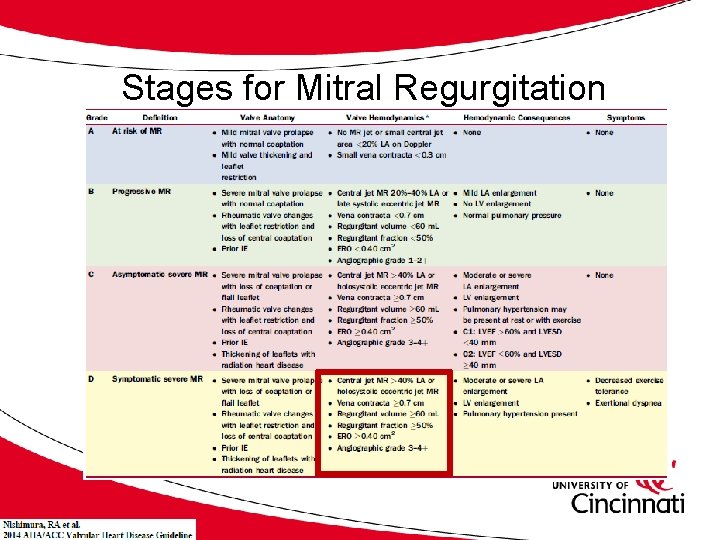 Stages for Mitral Regurgitation 