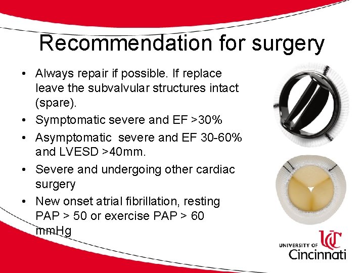 Recommendation for surgery • Always repair if possible. If replace leave the subvalvular structures