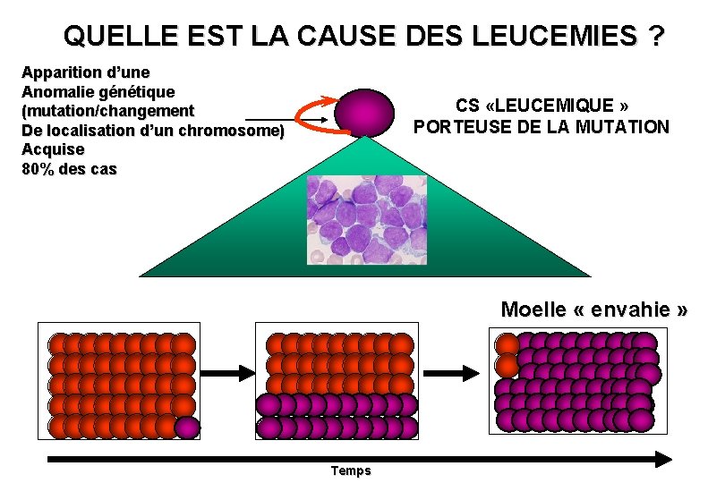 QUELLE EST LA CAUSE DES LEUCEMIES ? Apparition d’une Anomalie génétique (mutation/changement De localisation