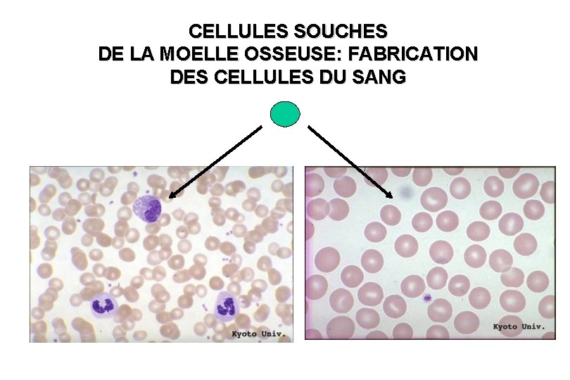 CELLULES SOUCHES DE LA MOELLE OSSEUSE: FABRICATION DES CELLULES DU SANG 