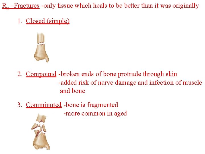 Rx –Fractures -only tissue which heals to be better than it was originally 1.