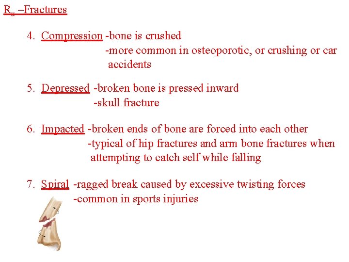 Rx –Fractures 4. Compression -bone is crushed -more common in osteoporotic, or crushing or