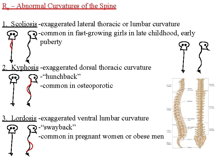 Rx – Abnormal Curvatures of the Spine 1. Scoliosis -exaggerated lateral thoracic or lumbar