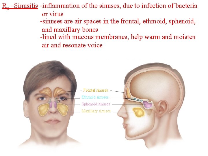 Rx –Sinusitis -inflammation of the sinuses, due to infection of bacteria or virus -sinuses