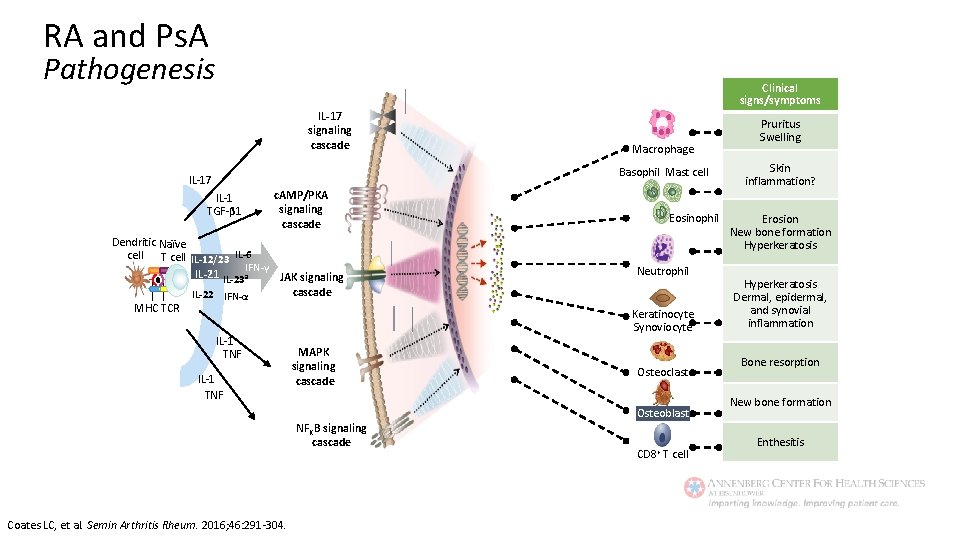 RA and Ps. A Pathogenesis Clinical signs/symptoms IL-17 signaling cascade Macrophage Basophil Mast cell