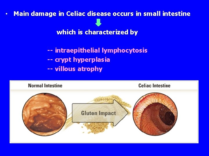  • Main damage in Celiac disease occurs in small intestine which is characterized