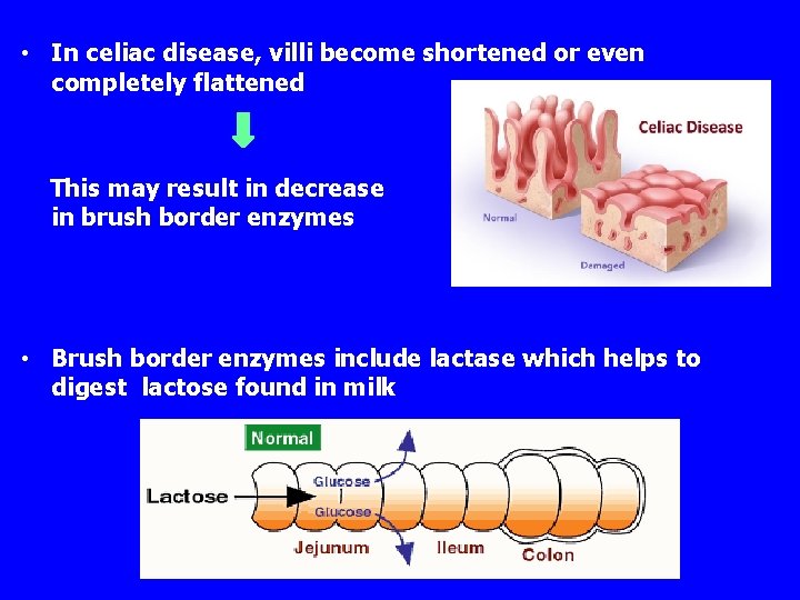  • In celiac disease, villi become shortened or even completely flattened This may