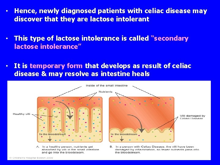  • Hence, newly diagnosed patients with celiac disease may discover that they are