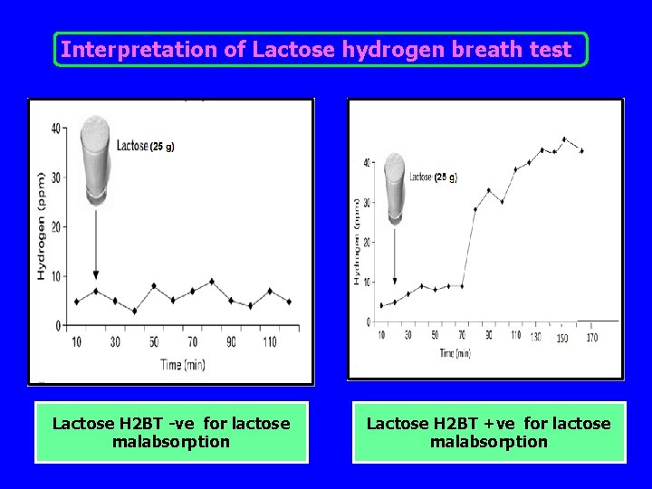 Interpretation of Lactose hydrogen breath test Lactose H 2 BT -ve for lactose malabsorption
