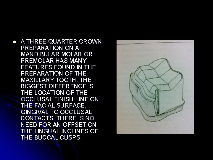 l A THREE-QUARTER CROWN PREPARATION ON A MANDIBULAR MOLAR OR PREMOLAR HAS MANY FEATURES