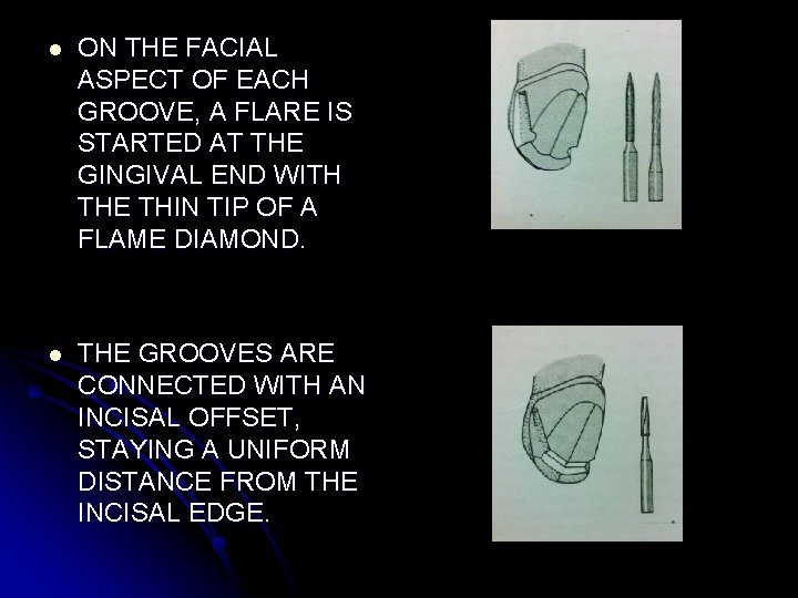 l ON THE FACIAL ASPECT OF EACH GROOVE, A FLARE IS STARTED AT THE