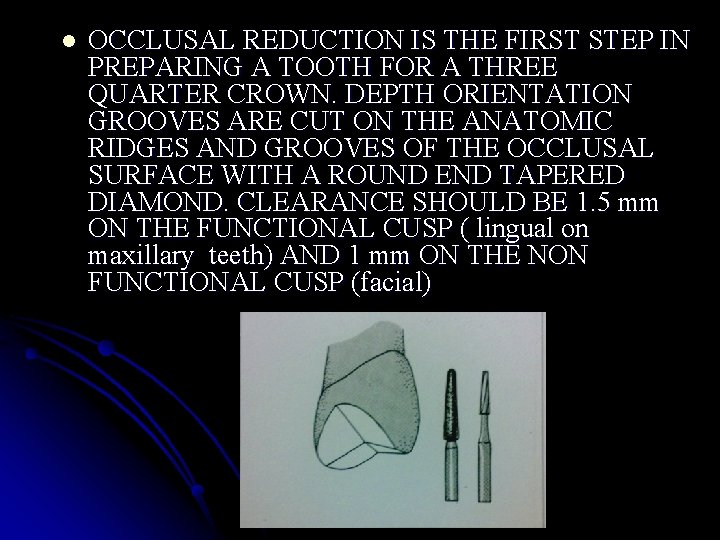 l OCCLUSAL REDUCTION IS THE FIRST STEP IN PREPARING A TOOTH FOR A THREE