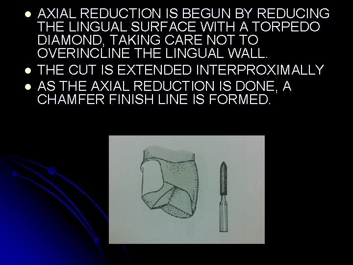 l l l AXIAL REDUCTION IS BEGUN BY REDUCING THE LINGUAL SURFACE WITH A