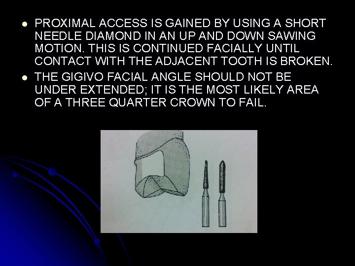 l l PROXIMAL ACCESS IS GAINED BY USING A SHORT NEEDLE DIAMOND IN AN